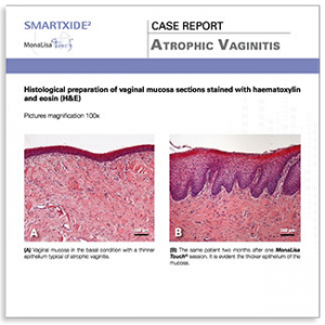 case-report3